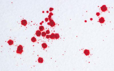 How to Remove Blood Spots from Carpet and Furniture
